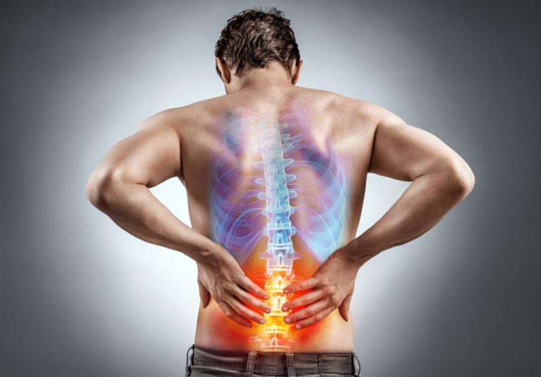 Lower Back Arthritis Symptoms